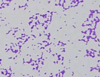 革兰氏阳性菌 革兰氏阳性菌